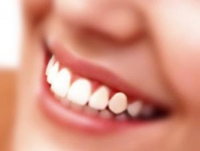 Implantologie dentara