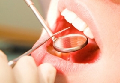Profilaxie dentara